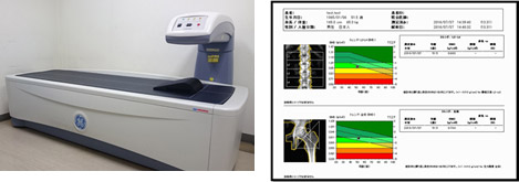 骨密度検査