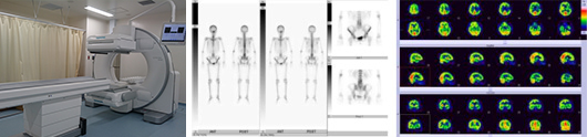 核医学検査