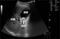 臨床検査科3 腹部超音波検査